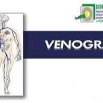 MR Venography Scan