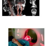 Neck CT Scan @ Omega PDS Pune