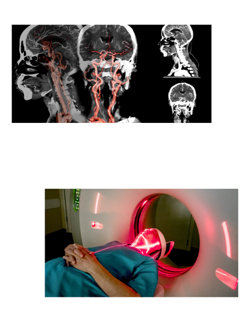 Neck CT Scan @ Omega PDS Pune